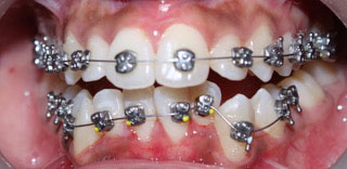 orthodontics