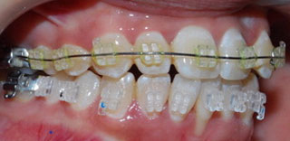 orthodontics