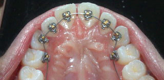 orthodontics